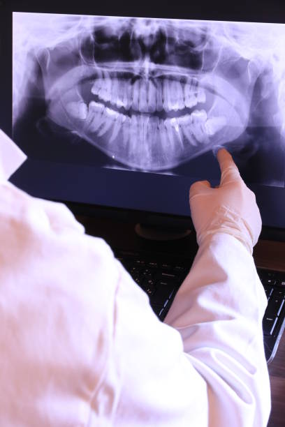 Best Emergency Tooth Extraction in Pompton Plains, NJ