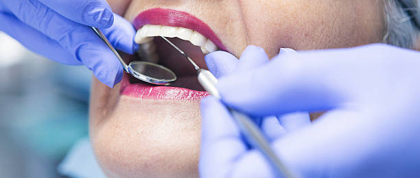 Best Emergency Broken Tooth Repair in Pompton Plains, NJ